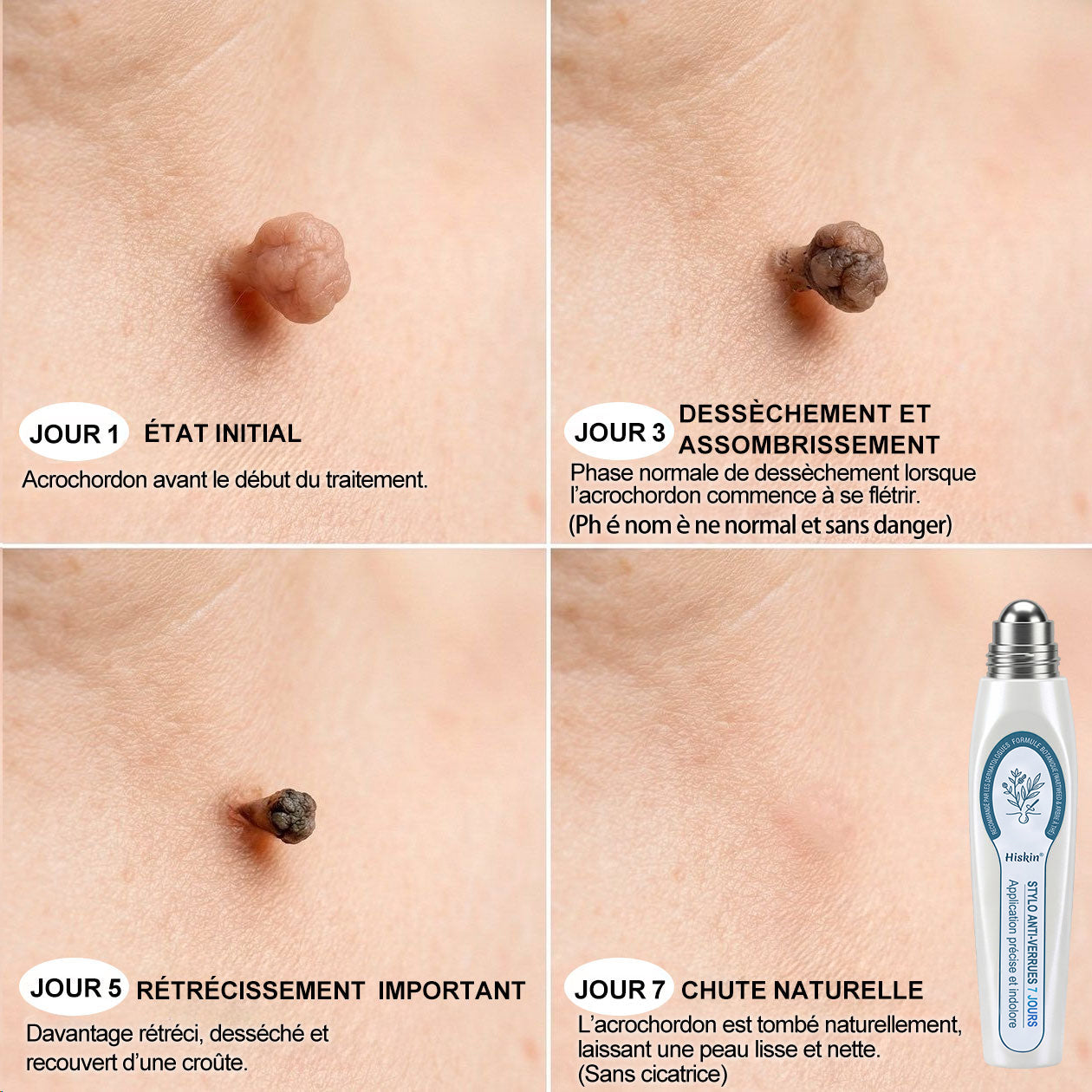 👩‍⚕️ Il ne reste plus que 10 boîtes ! 🎁 Nous offrons une remise supplémentaire de 30 % ! Prenez soin de votre santé ! Si vous manquez cette offre, il n'y en aura plus cette année !