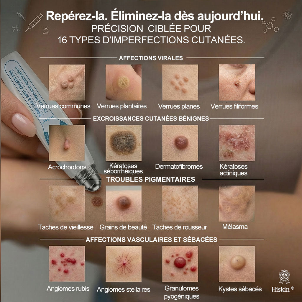 👩‍⚕️ Il ne reste plus que 10 boîtes ! 🎁 Nous offrons une remise supplémentaire de 30 % ! Prenez soin de votre santé ! Si vous manquez cette offre, il n'y en aura plus cette année !