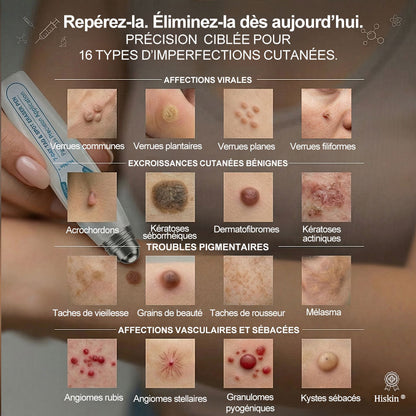 👩‍⚕️ Il ne reste plus que 10 boîtes ! 🎁 Nous offrons une remise supplémentaire de 30 % ! Prenez soin de votre santé ! Si vous manquez cette offre, il n'y en aura plus cette année !