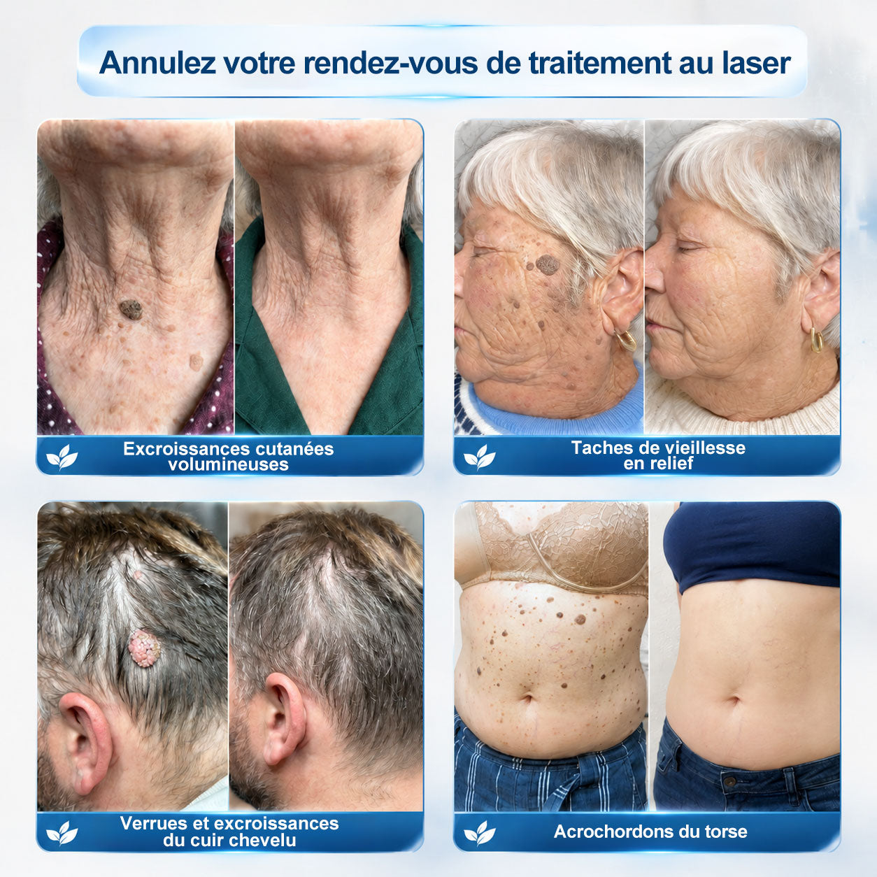 👩‍⚕️ Il ne reste plus que 10 boîtes ! 🎁 Nous offrons une remise supplémentaire de 30 % ! Prenez soin de votre santé ! Si vous manquez cette offre, il n'y en aura plus cette année !
