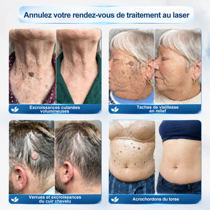 👩‍⚕️ Il ne reste plus que 10 boîtes ! 🎁 Nous offrons une remise supplémentaire de 30 % ! Prenez soin de votre santé ! Si vous manquez cette offre, il n'y en aura plus cette année !