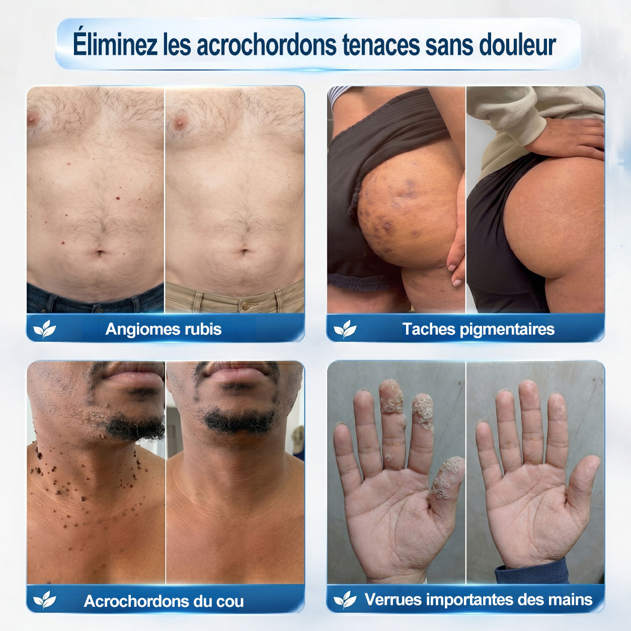 👩‍⚕️ Il ne reste plus que 10 boîtes ! 🎁 Nous offrons une remise supplémentaire de 30 % ! Prenez soin de votre santé ! Si vous manquez cette offre, il n'y en aura plus cette année !