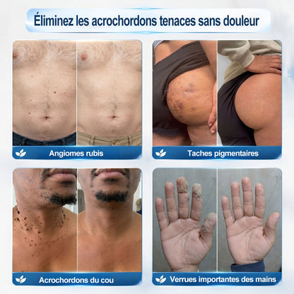 👩‍⚕️ Il ne reste plus que 10 boîtes ! 🎁 Nous offrons une remise supplémentaire de 30 % ! Prenez soin de votre santé ! Si vous manquez cette offre, il n'y en aura plus cette année !