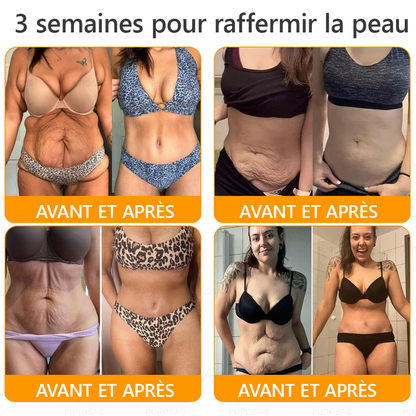 ⏰ Il ne reste plus que 10 pots d’PUROSA® en super promo ! Profitez de 30 % de rabais supplémentaires et avancez vers une vie plus saine. Après, il faudra attendre l’année prochaine !