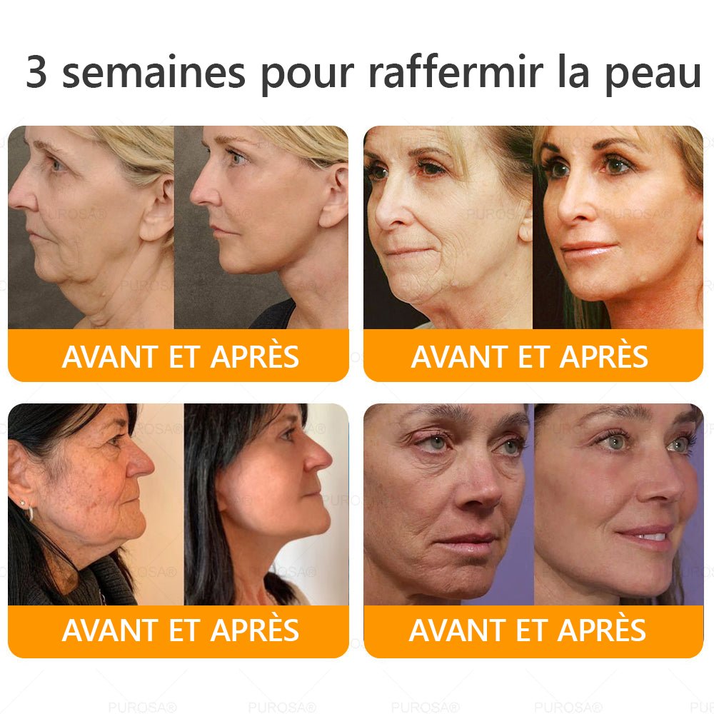 ⏰ Il ne reste plus que 10 pots d’PUROSA® en super promo ! Profitez de 30 % de rabais supplémentaires et avancez vers une vie plus saine. Après, il faudra attendre l’année prochaine !