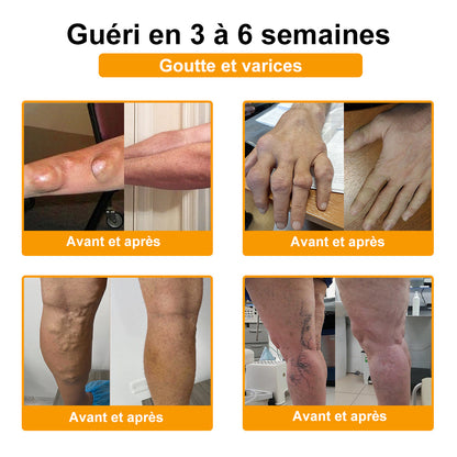 ADNOON®  Crème de guérison des os et de soulagement de la douleur au Botox et venin d'abeille