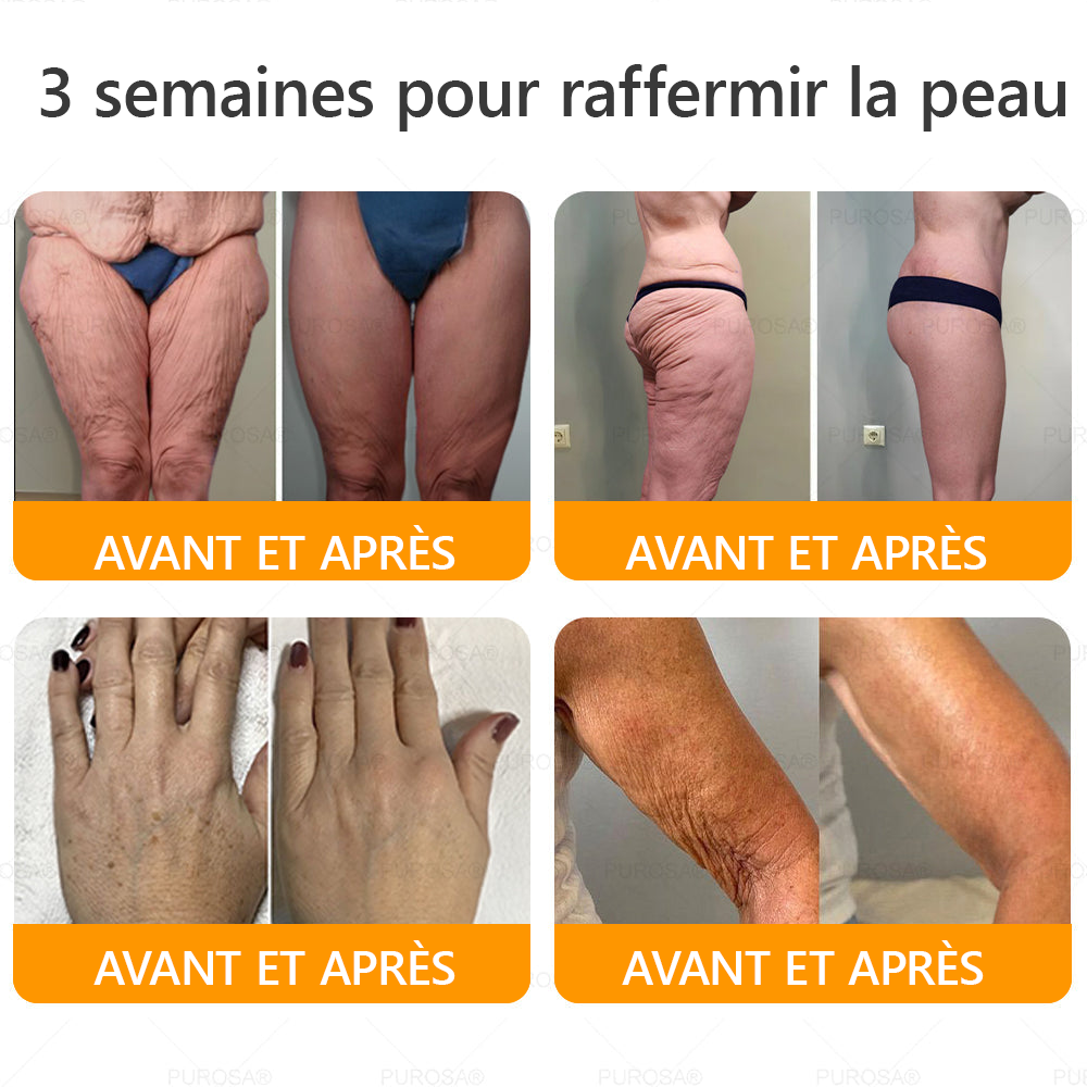⏰ Il ne reste plus que 10 pots d’PUROSA® en super promo ! Profitez de 30 % de rabais supplémentaires et avancez vers une vie plus saine. Après, il faudra attendre l’année prochaine !